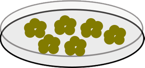 dementia research